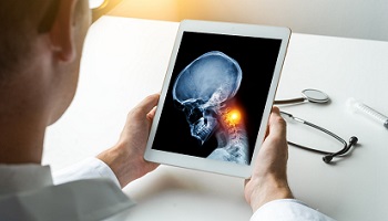 Scientist looking at iPad device depicting skeletal image of head and neck cancer