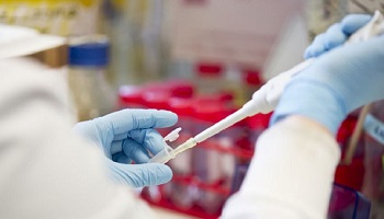 Researcher in lab using pipette
