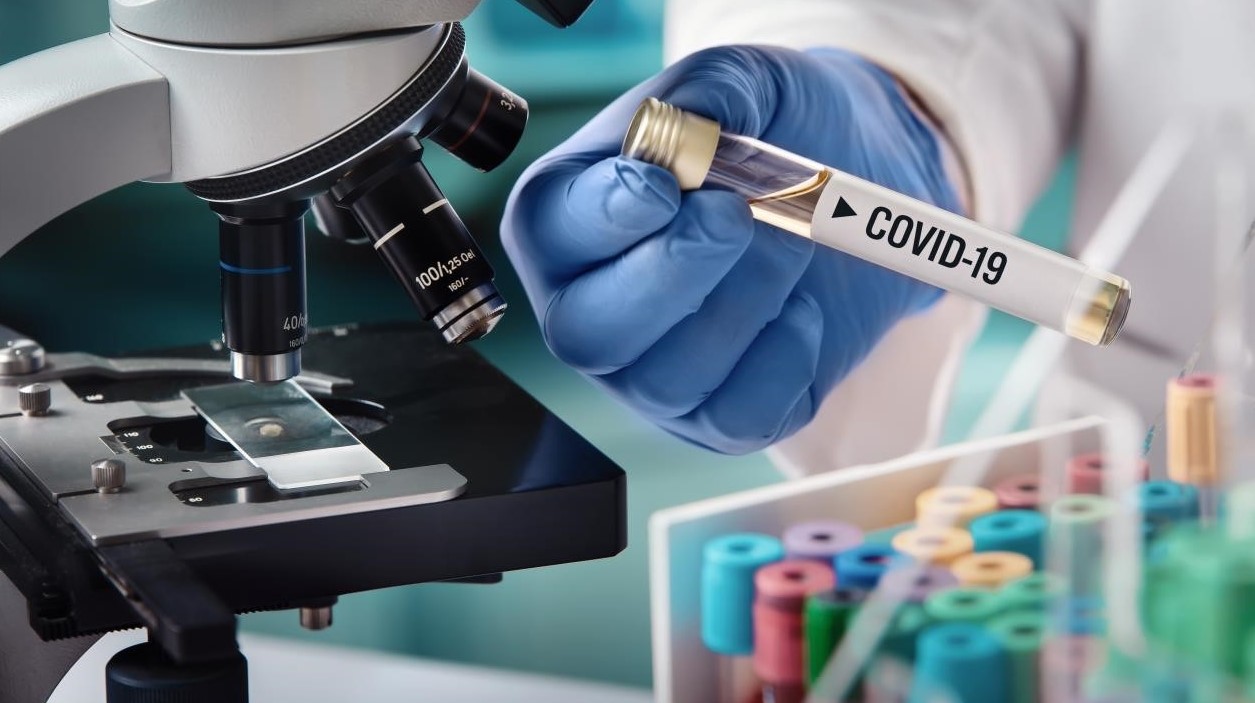 COVID-19 test tube held by researcher in laboratory