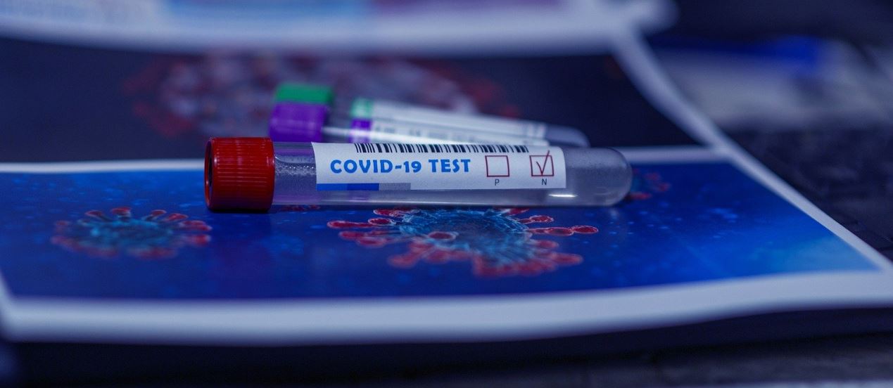 COVID-19 test vial ticked for negative
