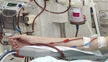 Patient's arm with blood transfusion lines