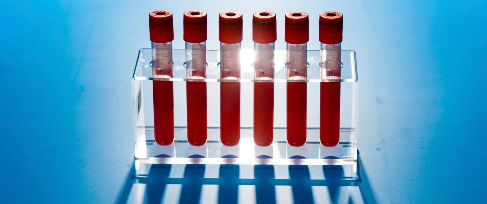 Six red-topped test-tubes in a rack each filled with blood